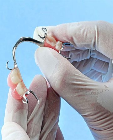 Dentist Hand With Medical Rubber Glove Holding Partial Dentures - Mobile — Crestwood Family Dental In Molendinar, QLD